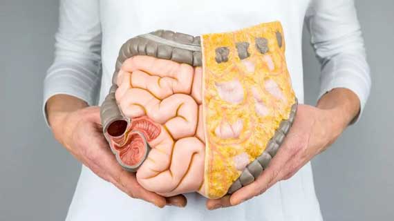 Colon & Rectal Dysfunctions